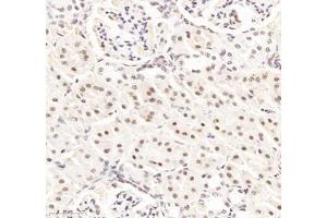 Immunohistochemistry of paraffin embedded rat kidney using RBM8A (ABIN7075478) at dilution of 1: 300 (300x lens) (RBM8A anticorps)