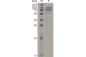 Mouse CD138 Protein, hFc Tag on SDS-PAGE under reducing condition.