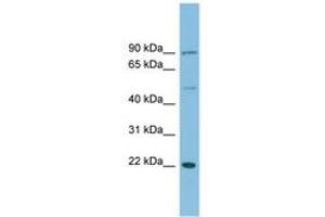 Image no. 1 for anti-DnaJ (Hsp40) Homolog, Subfamily C, Member 12 (DNAJC12) (C-Term) antibody (ABIN6745162) (DNAJC12 anticorps  (C-Term))