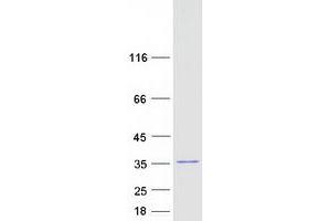 Validation with Western Blot