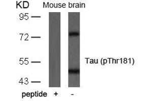 Western blot analysis of extracts from mouse brain tissue using Tau(Phospho-Thr181) Antibody and the same antibody preincubated with blocking peptide. (MAPT anticorps  (pThr181))