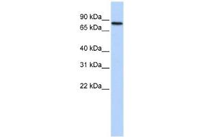 ADARB2 antibody used at 1 ug/ml to detect target protein.