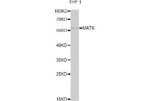 Western blot analysis of extracts of THP-1 cells, using MATK antibody.