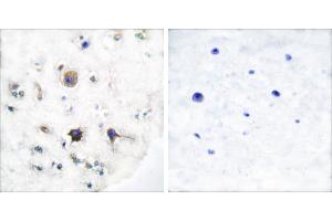 Peptide - +Immunohistochemical analysis of paraffin-embedded human brain tissue using Ephrin-B3 antibody (#C0182). (Ephrin B3 anticorps)