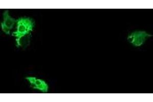 Image no. 2 for anti-NIMA (Never In Mitosis Gene A)-Related Kinase 11 (NEK11) antibody (ABIN1499682)