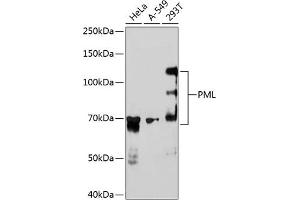 Western blot analysis of extracts of various cell lines, using PML antibody (ABIN7269565) at 1:1000 dilution.