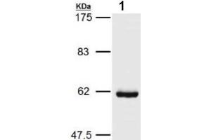 Western blot analysis of HSP60 expression in COLO205 cells (HSPD1 anticorps)