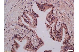 Formalin-fixed and paraffin embedded human prostate tissue labeled with Anti-LMAN1 Polyclonal Antibody, Unconjugated  at 1:300 followed by conjugation to the secondary antibody and DAB staining.