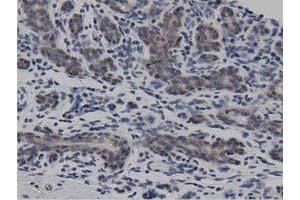 Immunohistochemical staining of paraffin-embedded Human breast tissue using anti-DNAJA2 mouse monoclonal antibody. (DNAJA2 anticorps)