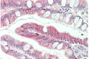 Human Small Intestine: Formalin-Fixed, Paraffin-Embedded (FFPE)