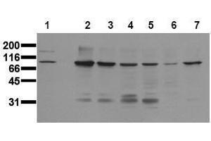 Western Blotting (WB) image for anti-Catenin (Cadherin-Associated Protein), beta 1, 88kDa (CTNNB1) (Core) antibody (ABIN126748) (CTNNB1 anticorps  (Core))