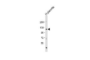 Anti-AD Antibody (Center) at 1:1000 dilution + human placenta lysate Lysates/proteins at 20 μg per lane.