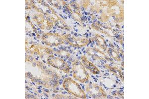 Immunohistochemistry of paraffin-embedded human kidney using ITGB5 antibody at dilution of 1:200 (x400 lens) (Integrin beta 5 anticorps  (AA 490-720))