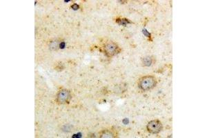 Immunohistochemical analysis of NTR1 staining in human brain formalin fixed paraffin embedded tissue section. (NTSR1 anticorps)