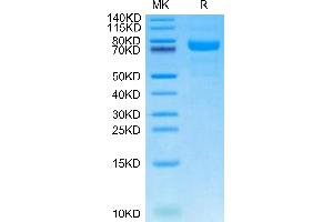 Leucine Rich Repeat Containing 15 (LRRC15) (AA 47-565) (Active) protein (His tag)