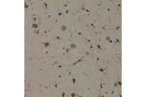 Immunohistochemistry of paraffin-embedded mouse brain using EEF1D antibody at dilution of 1:200 (400x lens). (EEF1D anticorps)