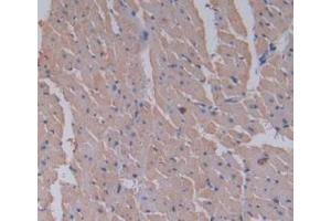 Detection of CBG in Rat Heart Tissue using Monoclonal Antibody to Corticosteroid Binding Globulin (CBG)