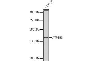 Western blot analysis of extracts of HCT116 cells, using B3 Rabbit pAb (ABIN7265751) at 1:1000 dilution.