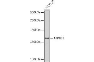 Western blot analysis of extracts of HCT116 cells, using B3 Rabbit pAb (ABIN7265751) at 1:1000 dilution. (ATP8B3 anticorps  (AA 600-900))