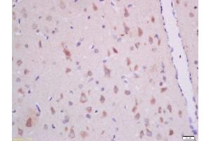 Formalin-fixed and paraffin embedded rat brain labeled with Anti-GHRH Polyclonal Antibody (ABIN726275) at 1:300 followed by conjugation to the secondary antibody and DAB staining. (GHRH anticorps  (AA 32-59))