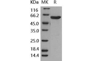 Western Blotting (WB) image for Mitogen-Activated Protein Kinase Kinase 6 (MAP2K6) protein (GST tag,His tag) (ABIN7317109) (MAP2K6 Protein (GST tag,His tag))