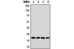 Western blot analysis of CHAC1 expression in U2OS (A), HeLa (B), Raw264. (CHAC1 anticorps  (N-Term))