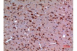 Immunohistochemistry (IHC) analysis of paraffin-embedded Rat Brain, antibody was diluted at 1:100.