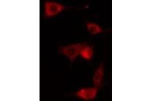 ABIN6275056 staining NIH-3T3 cells by IF/ICC. (DHPS anticorps  (Internal Region))