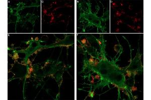 Live cell imaging of Hm1a-ATTO Fluor-647N in differentiated  cells. (Hm1a Toxin Peptide)