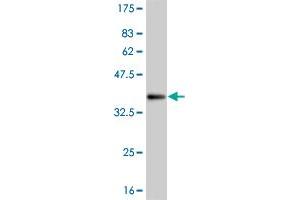 Western Blot detection against Immunogen (35.