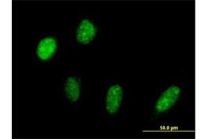 Immunofluorescence of purified MaxPab antibody to PRPF18 on HeLa cell.