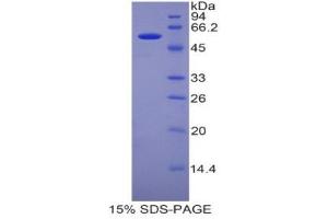 SDS-PAGE (SDS) image for Pregnancy Zone Protein (PZP) (AA 1224-1495) protein (His tag,GST tag) (ABIN1878429)