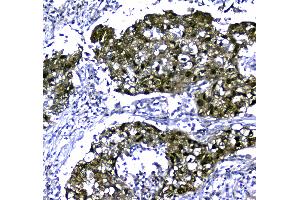 IHC analysis of STUB1 using anti-STUB1 antibody . (STUB1 anticorps  (AA 51-303))