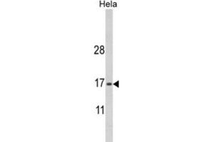 Western Blotting (WB) image for anti-MpV17 Mitochondrial Inner Membrane Protein (MPV17) antibody (ABIN3003896)