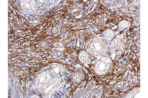 IHC-P Image ITI-H3 antibody [N1N3] detects ITI-H3 protein at secreted on mouse cervix by immunohistochemical analysis. (ITIH3 anticorps)
