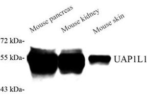 Western blot analysis of UAP1L1 (ABIN7076143) at dilution of 1: 2000 (UAP1L1 anticorps)