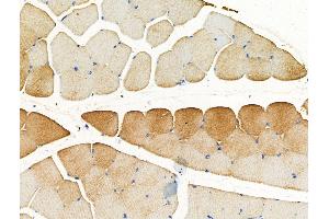 ABIN7094666 and ABIN7098717 at 1/100 staining Rat muscle tissue by IHC-P.