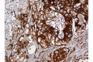 Image no. 14 for anti-SERPINE1 mRNA Binding Protein 1 (SERBP1) (AA 1-262) antibody (ABIN1490675)