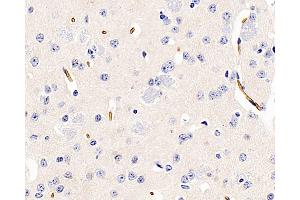 Immunohistochemistry analysis of paraffin-embedded Mouse brain using AQP1 Polyclonal Antibody at dilution of 1:400. (Aquaporin 1 anticorps)