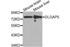 Western blot analysis of extracts of various tissues, using DLGAP5 antibody. (DLGAP5 anticorps  (AA 547-846))