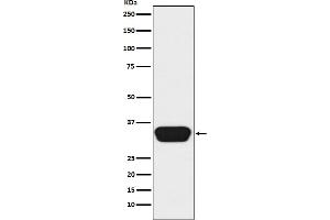 Western blot analysis of Otx1/2 expression in Y79 cell lysate.