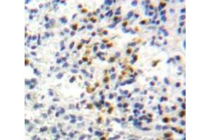 Used in DAB staining on fromalin fixed paraffin-embedded Spleen tissue