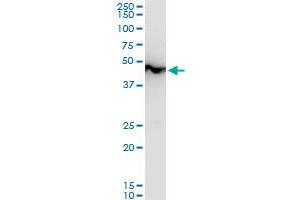ENO1 polyclonal antibody (A01), Lot # SFU4050831QCS1.