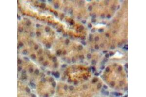 IHC-P analysis of Kidney tissue, with DAB staining. (CST5 anticorps  (AA 21-142))