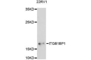 Western blot analysis of extracts of 22RV1 cells, using ITGB1BP1 antibody (ABIN6290512) at 1:3000 dilution. (ITGB1BP1 anticorps)