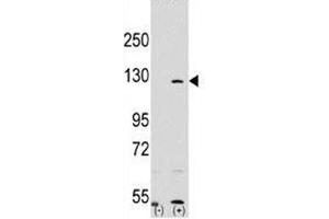 Western blot analysis of PARP antibody and 293 cell lysate (2 ug/lane) either nontransfected (Lane 1) or transiently transfected with the PARP1 gene (2).