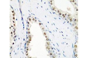 Immunohistochemistry of paraffin-embedded Human prostate using SF3B3 Polyclonal Antibody at dilution of 1:200 (40x lens).