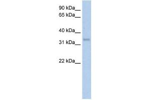 Carbonic Anhydrase IV antibody used at 5 ug/ml to detect target protein.