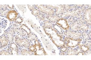 Detection of KLK1 in Human Kidney Tissue using Polyclonal Antibody to Kallikrein 1 (KLK1)