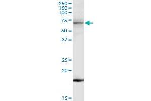 TNK2 MaxPab rabbit polyclonal antibody. (TNK2 anticorps  (AA 1-352))